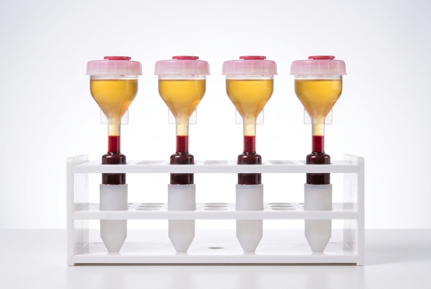 Buizen met gescheiden plasma en bloed ter voorbereiding van een plasma infuus bij Neo Clinics